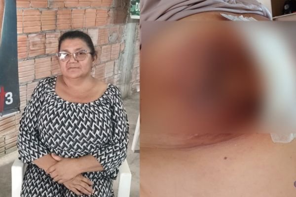 apos-perder-casa-e-beneficio-d