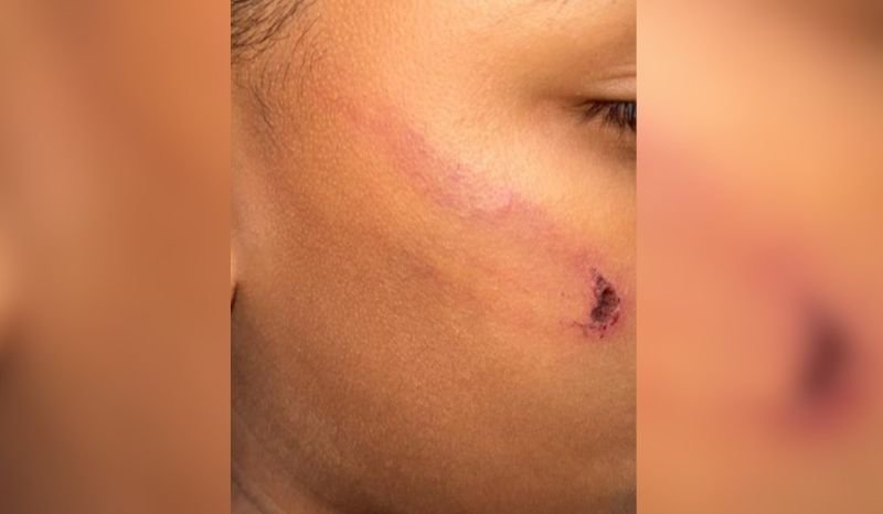 crianca-perde-dente-ao-ser-agr