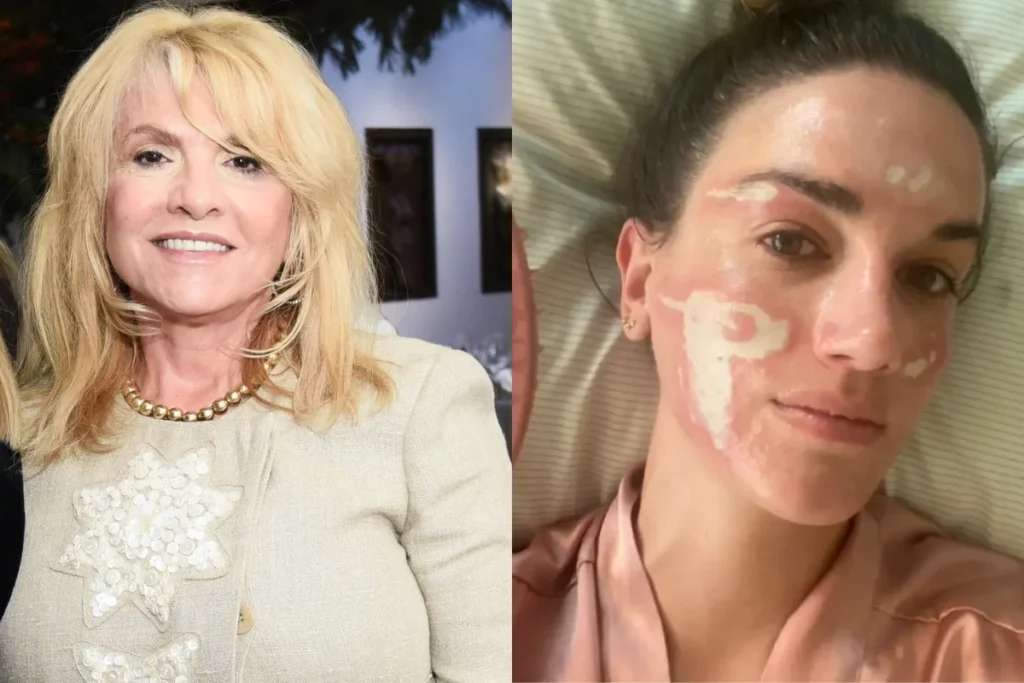 escandalo-em-hollywood-estetic