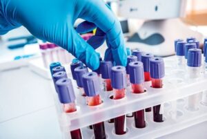 exame-de-sangue-promete-transf